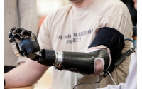 Daily Rehabilitation Training Method of Upper Limb Prosthetics (Hand Prosthetics)